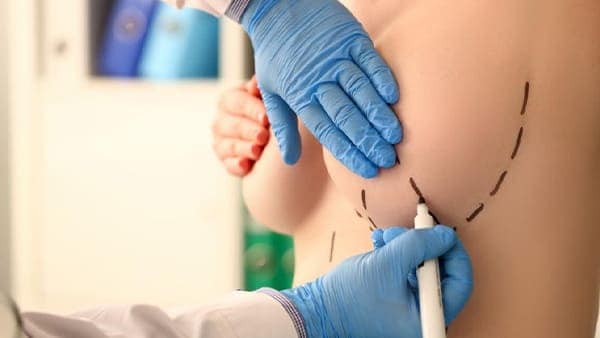 reduction mammaire docteur hocine bouabid chirurgien esthetique paris 5 chirurgien plasticien paris 5